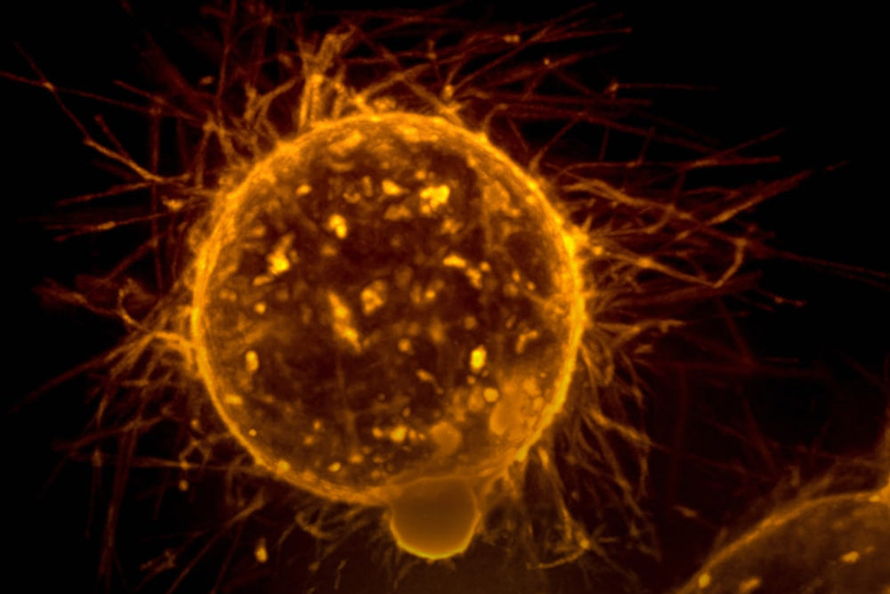 Mesenchymal Stem Cell 